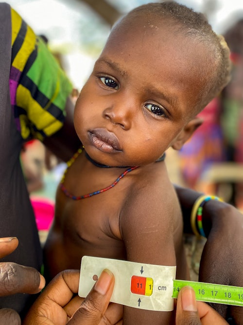 could help run a vital nutrition centre for two weeks, so we can diagnose and treat children to prevent them from suffering severe malnutrition