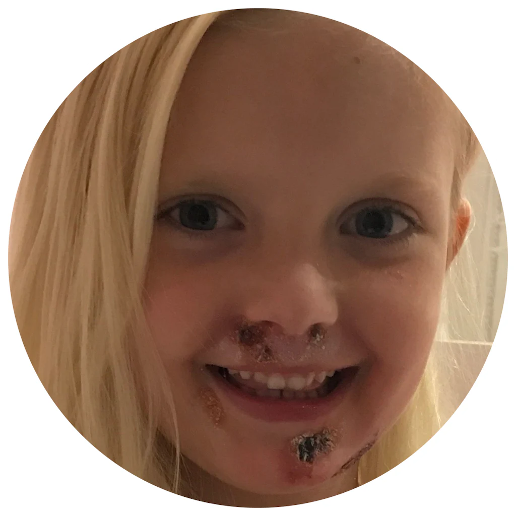Cure EB Foundation | Funding Research to End Epidermolysis Bullosa